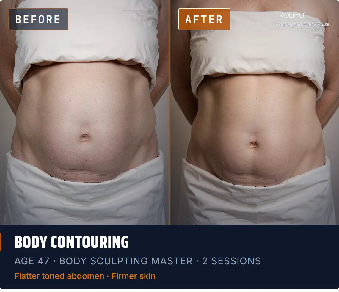 BODY SCULPTING MASTER antes y después
