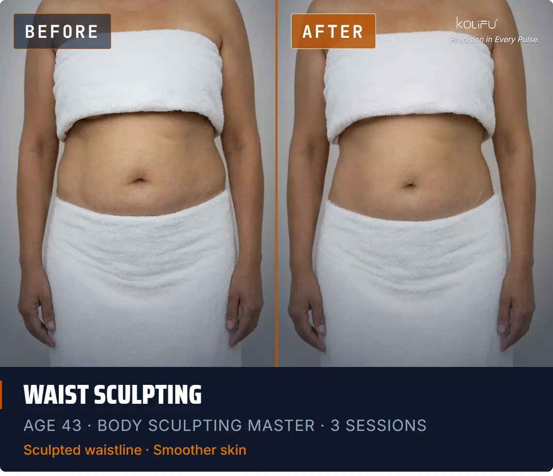 BODY SCULPTING MASTER antes y después