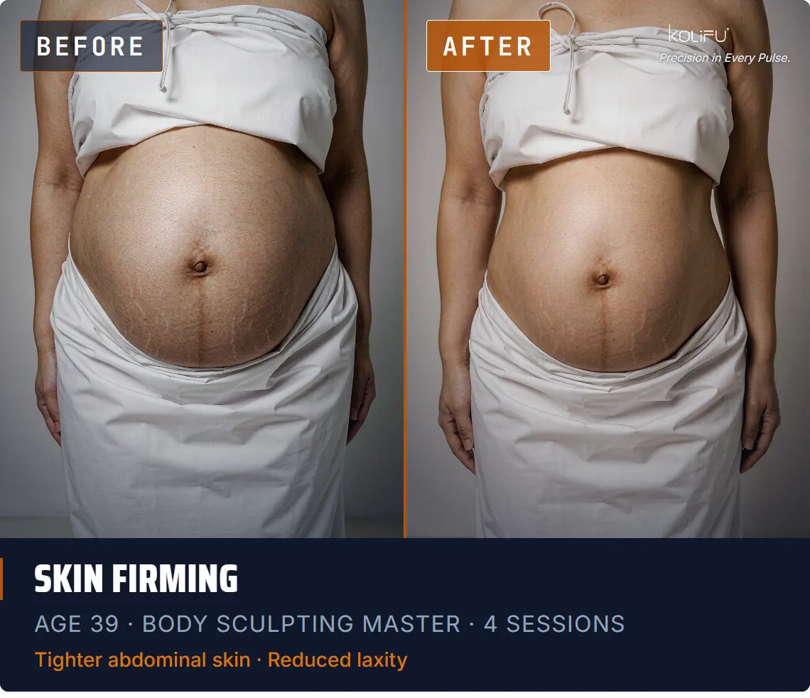 BODY SCULPTING MASTER antes y después