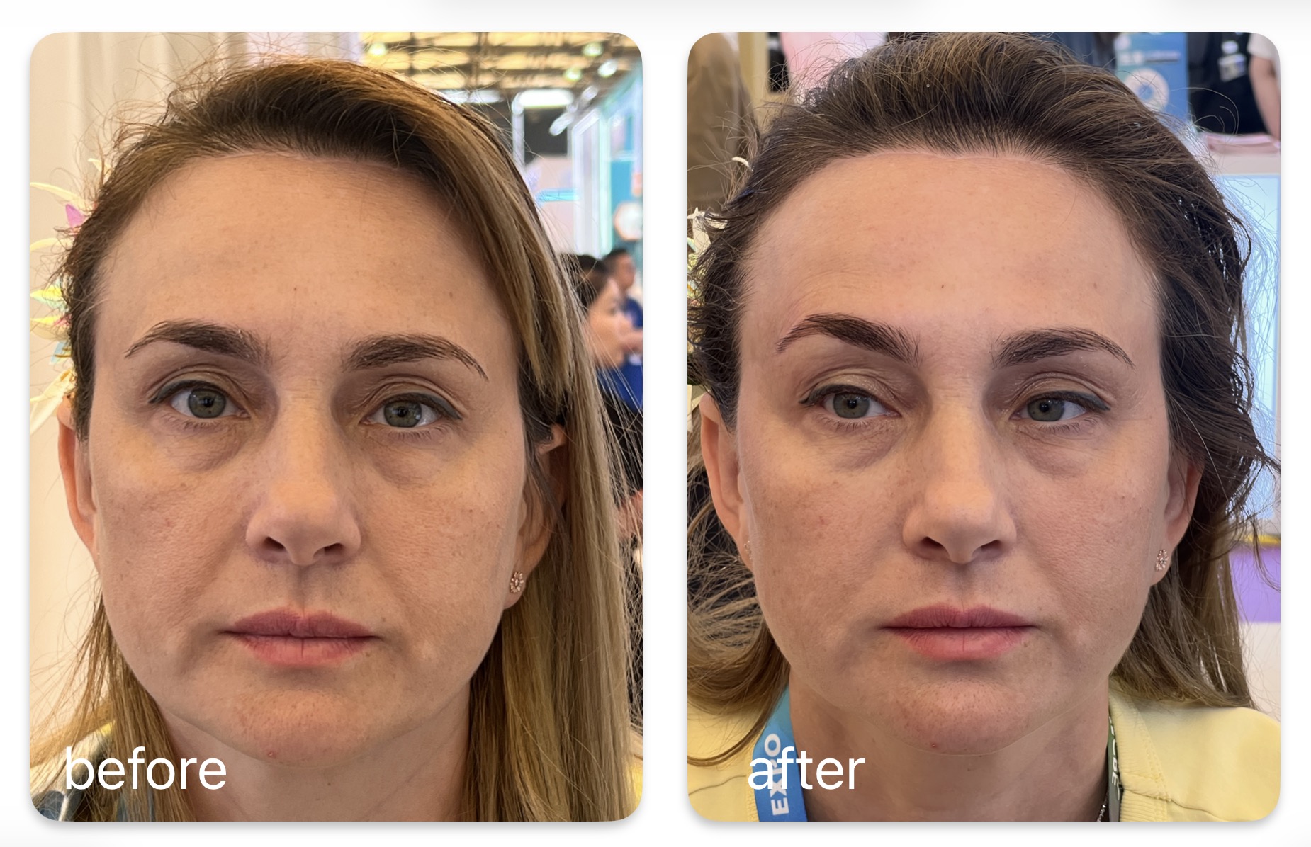 CPT TIME PRINCESS before and after