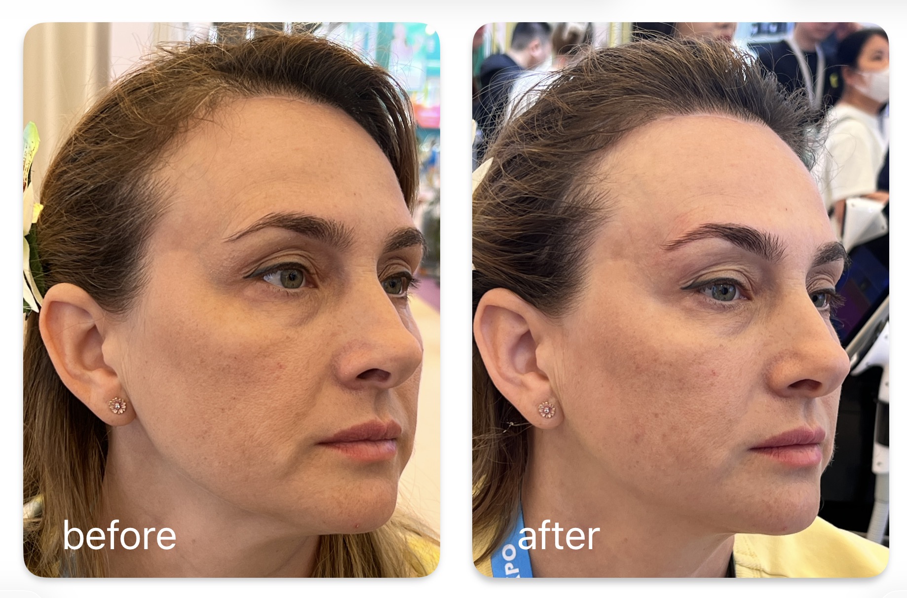 CPT TIME PRINCESS before and after