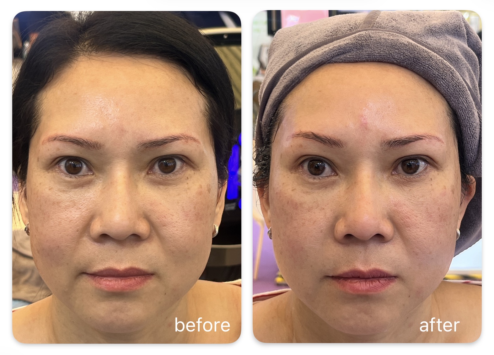 CPT TIME PRINCESS before and after