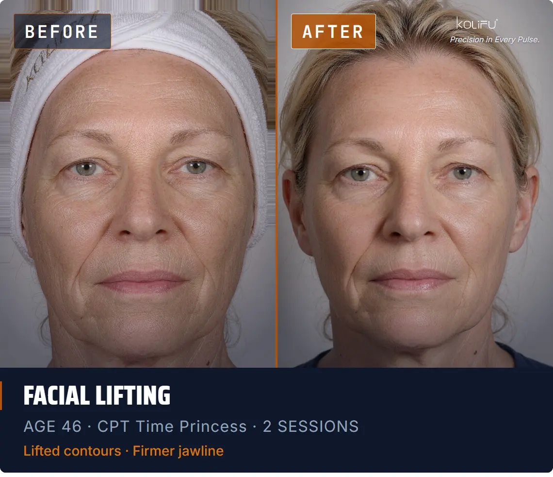 CPT TIME PRINCESS before and after