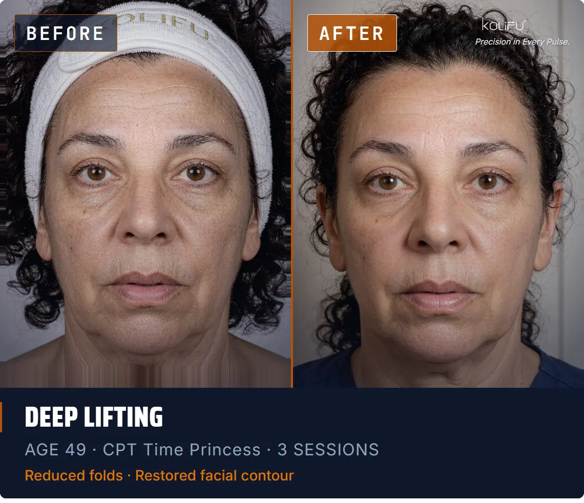 CPT TIME PRINCESS before and after