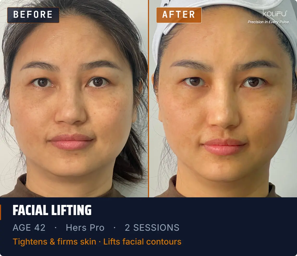 HERS PRO antes y después