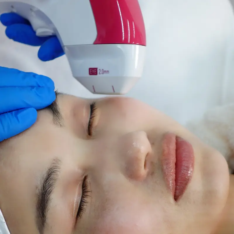 MMFU ULTRASOUND