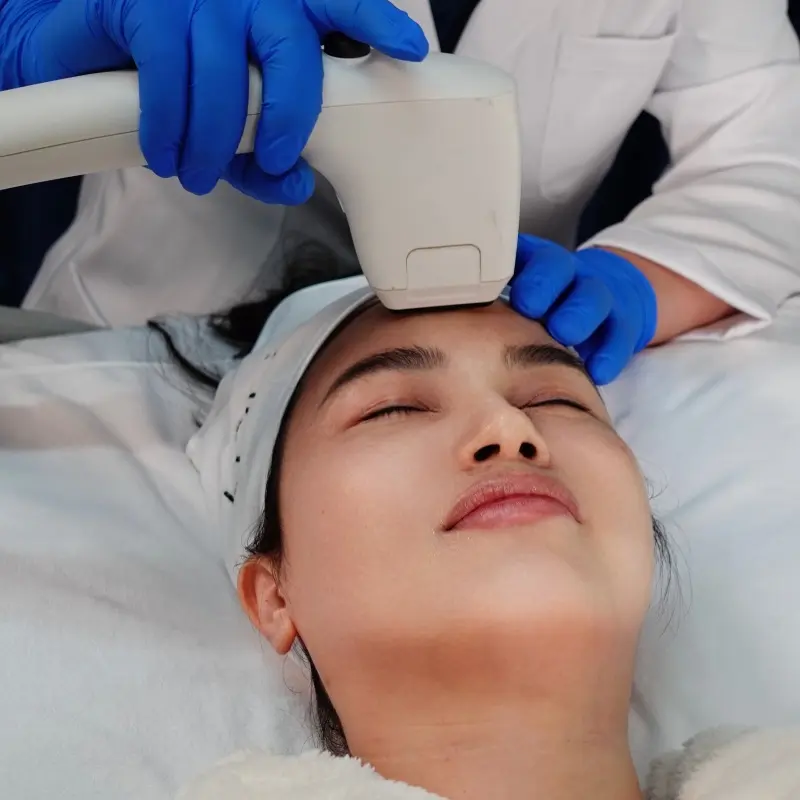 YOUNG FACIAL RF